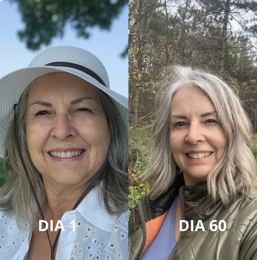 Resultado Dia 1 vs Dia 60